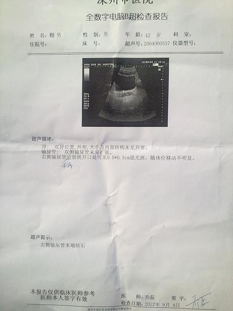 智能气功治疗肾结石
