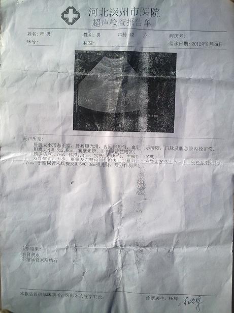 智能气功治疗肾结石