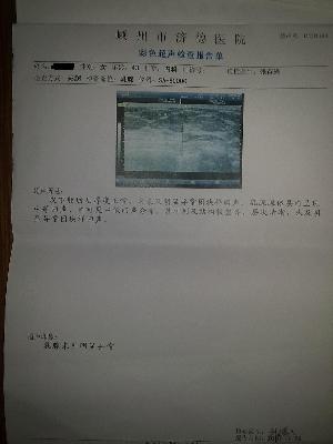智能气功